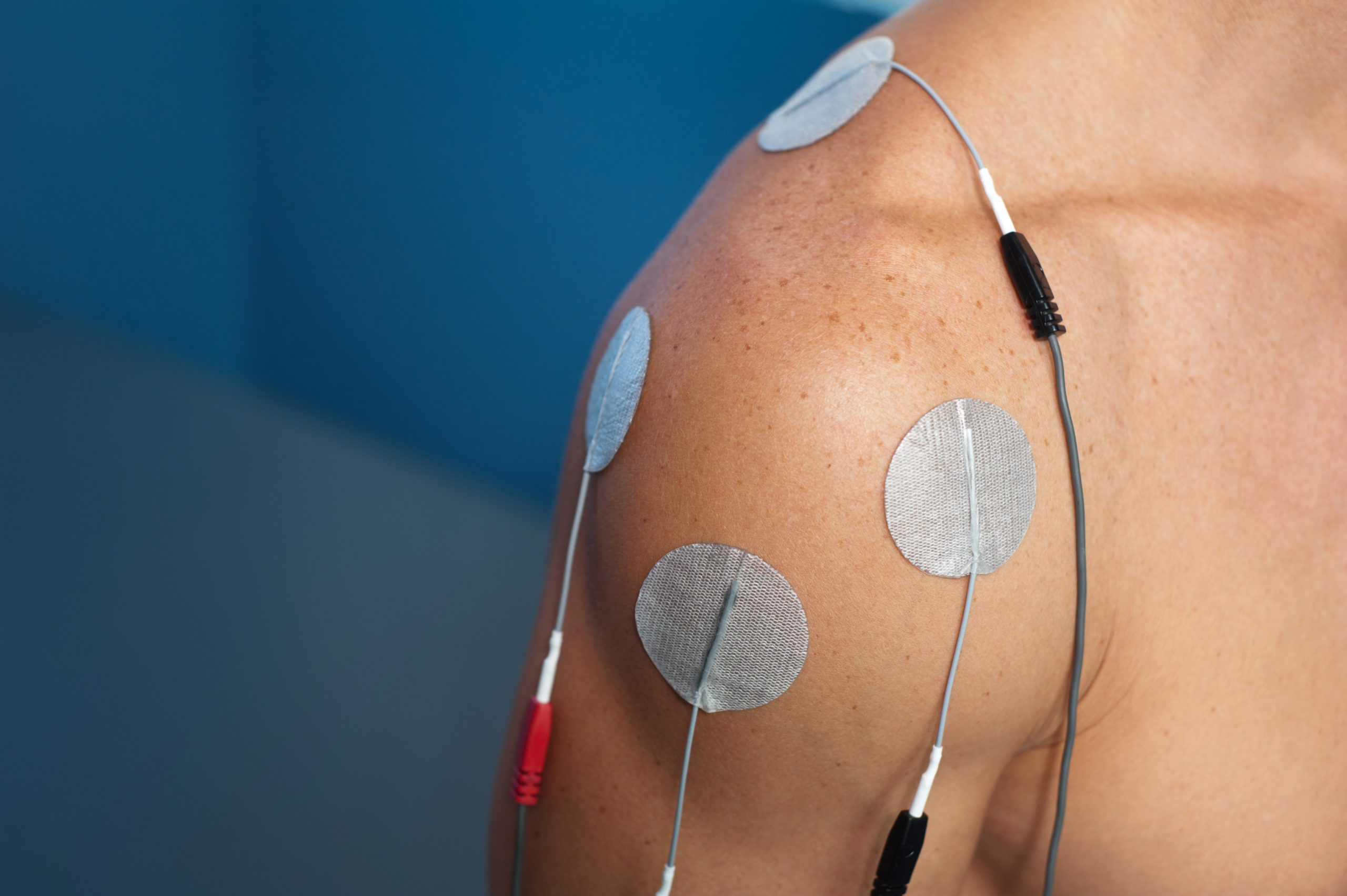 What Can Electric Stimulation Therapy Do For Your Pain?